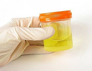 Urine Drug Testing